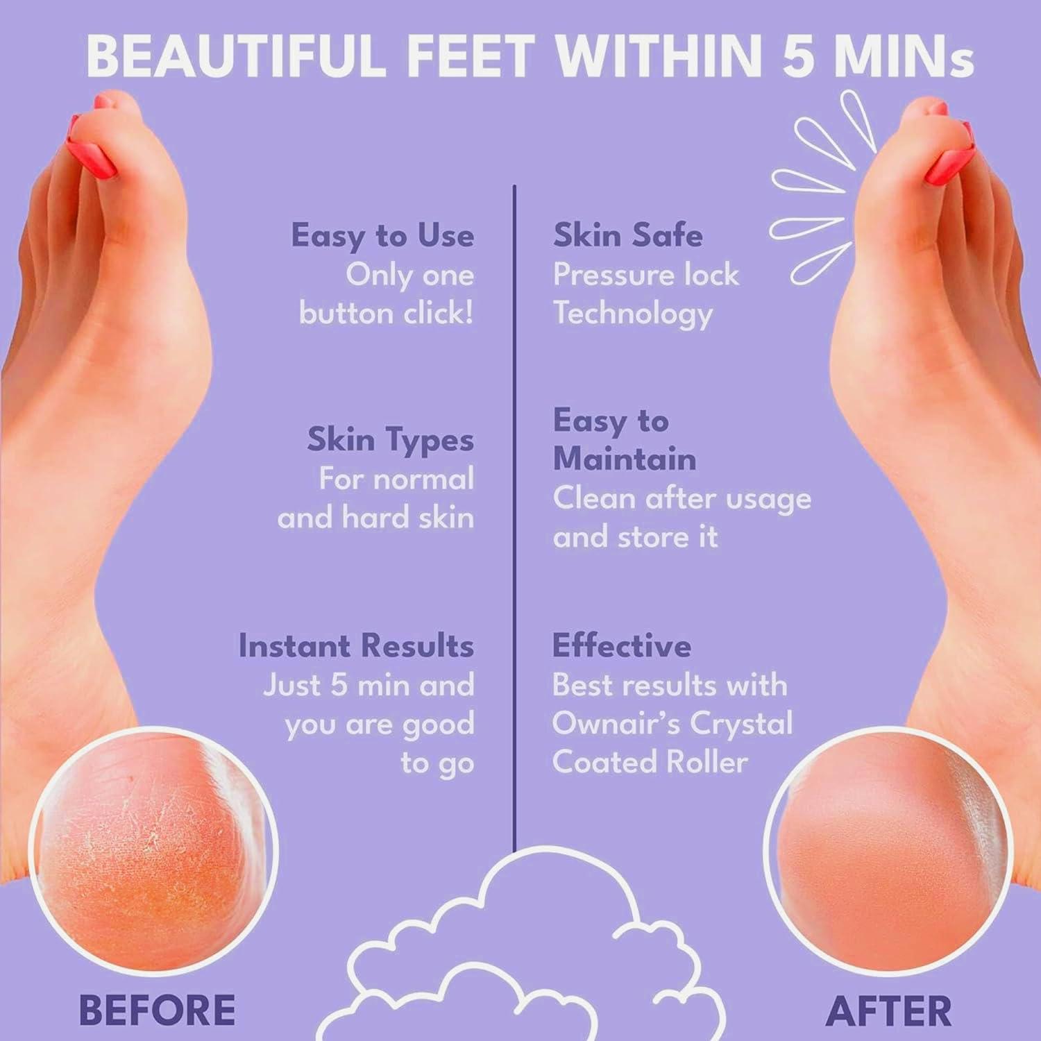 showcase beautiful feets within 5 mins with ownair callus remover at home