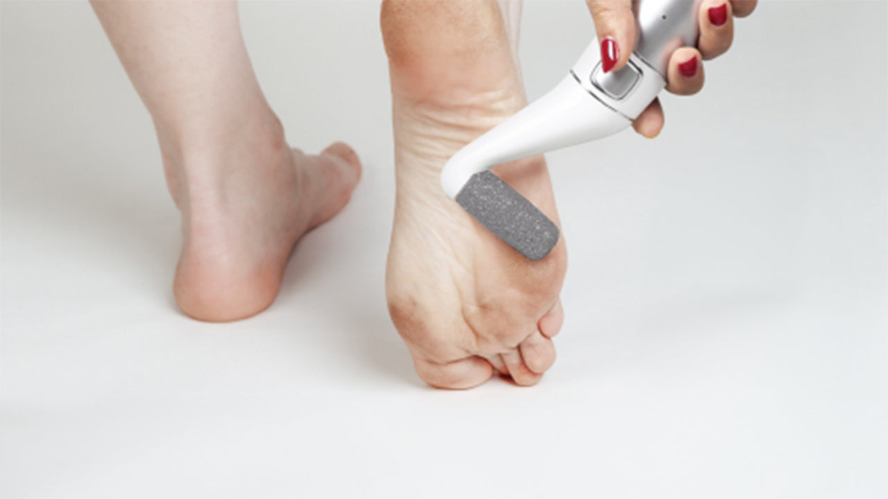 The Importance of Removing Calluses from the Feet : OWNAIR